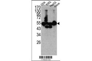 Image no. 1 for anti-Carboxypeptidase N Subunit 1 (CPN1) (AA 52-81), (N-Term) antibody (ABIN391509)