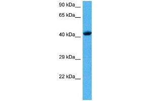 Image no. 3 for anti-Transcription Factor AP-2 alpha (Activating Enhancer Binding Protein 2 Alpha) (TFAP2A) (C-Term) antibody (ABIN2792629)