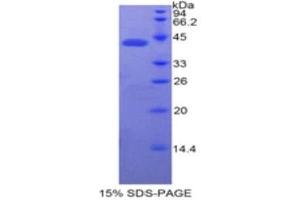 Image no. 1 for Bactericidal/Permeability Increasing Protein (BPI) (AA 320-456) protein (His tag,GST tag) (ABIN1878302)