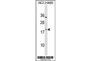 Image no. 1 for anti-Platelet Factor 4 Variant 1 (PF4V1) (AA 77-104), (C-Term) antibody (ABIN1537587)