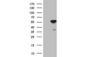 Image no. 2 for anti-4-Aminobutyrate Aminotransferase (ABAT) (AA 29-323) antibody (ABIN2715600)