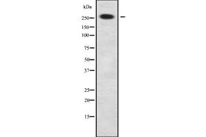 Image no. 1 for anti-Neuroblastoma Amplified Sequence (NBAS) (Internal Region) antibody (ABIN6263524)