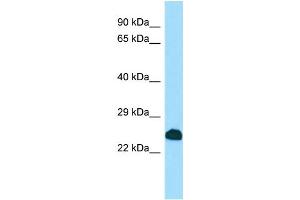 Image no. 1 for anti-Sodium Channel Modifier 1 (SCNM1) (C-Term) antibody (ABIN2790229)