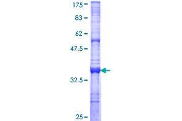 Dymeclin (DYM) (AA 343-430) protein (GST tag)