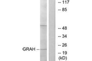 Image no. 1 for anti-Granzyme H (Cathepsin G-Like 2, Protein H-CCPX) (GZMH) (AA 51-100) antibody (ABIN1534447)