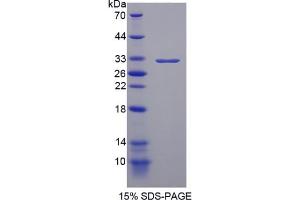 Image no. 3 for Promyelocytic Leukemia (PML) ELISA Kit (ABIN6720583)