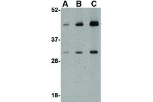 Image no. 1 for anti-TAR DNA Binding Protein (TARDBP) (C-Term) antibody (ABIN6656395)