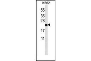 Image no. 1 for anti-Mitochondrially Encoded NADH Dehydrogenase 3 (MT-ND3) (AA 9-39), (N-Term) antibody (ABIN953620)