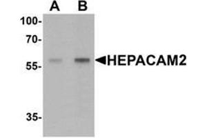 Image no. 1 for anti-HEPACAM Family Member 2 (HEPACAM2) (C-Term) antibody (ABIN1450023)