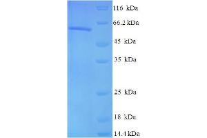 Image no. 1 for Casein Kinase 2 alpha 1 (CSNK2A1) (AA 1-391), (full length) protein (His-SUMO Tag) (ABIN5709345)
