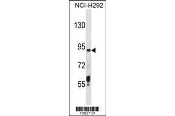 anti-Transmembrane Protease, serine 6 (TMPRSS6) (AA 85-114), (N-Term) antibody