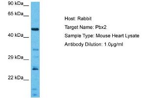 Image no. 3 for anti-Pre-B-Cell Leukemia Homeobox Protein 2 (PBX2) (N-Term) antibody (ABIN2780440)