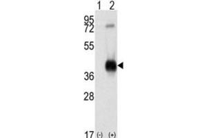 Image no. 3 for anti-Calcium/calmodulin-Dependent Protein Kinase I (CAMK1) antibody (ABIN3003045)