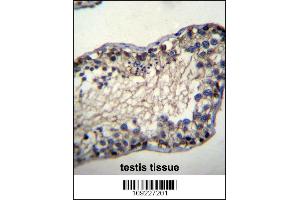 Image no. 1 for anti-Testis-Specific Serine Kinase 6 (TSSK6) (AA 25-54), (N-Term) antibody (ABIN656395)