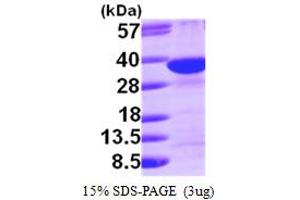SDCBP Protein (Syndecan Binding Protein (Syntenin)) (AA 1-298) (His tag)