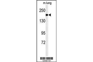 Image no. 2 for anti-alpha-2-Macroglobulin-Like 1 (A2ML1) (AA 345-373), (N-Term) antibody (ABIN650922)
