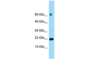 Image no. 1 for anti-Adenosine Deaminase, tRNA-Specific 2 (ADAT2) (C-Term) antibody (ABIN2790512)