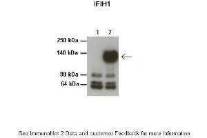 Image no. 2 for anti-Interferon Induced with Helicase C Domain 1 (IFIH1) (Middle Region) antibody (ABIN2775253)