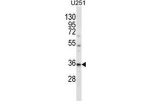 Image no. 1 for anti-Vacuolar Protein Sorting 37 Homolog B (VPS37B) (AA 98-127), (Middle Region) antibody (ABIN955524)