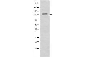 Image no. 2 for anti-Aminoadipate Semialdehyde Synthase (AASS) (C-Term) antibody (ABIN6257799)