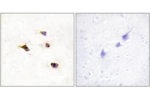 Image no. 2 for anti-Inositol Hexakisphosphate Kinase 3 (IP6K3) (AA 201-250) antibody (ABIN1534075)
