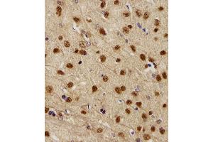 Image no. 1 for anti-NIMA (Never in Mitosis Gene A)-Related Kinase 2 (NEK2) (AA 396-426) antibody (ABIN5537201)