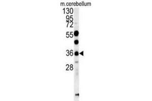 Image no. 1 for anti-OTU Domain Containing 6B (OTUD6B) antibody (ABIN3002448)