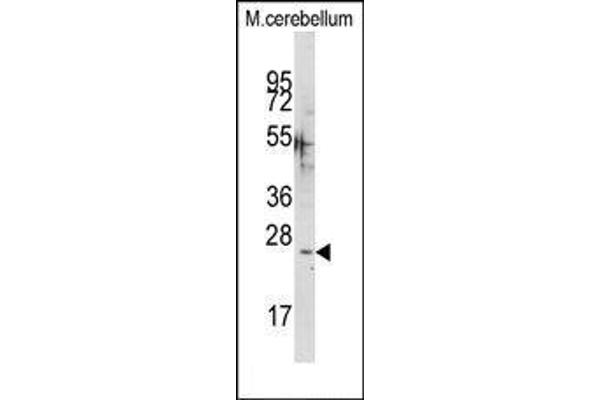 CABP1 anticorps  (C-Term)