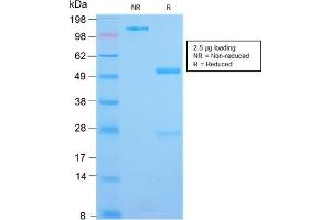 Image no. 1 for anti-Interleukin 3 Receptor, alpha (Low Affinity) (IL3RA) (AA 26-171) antibody (ABIN6939784)