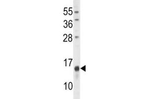 Image no. 2 for anti-Osteocalcin (BGLAP) (AA 2-32) antibody (ABIN3030174)