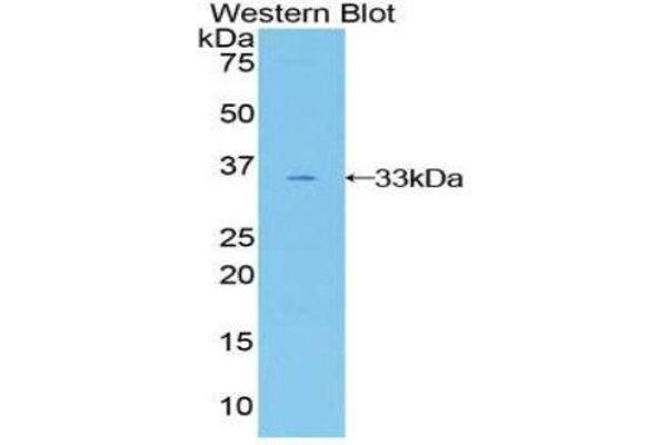 GAB3 Antikörper  (AA 332-583)