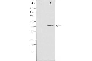Image no. 1 for anti-Carbohydrate (N-Acetylglucosamine-6-O) Sulfotransferase 2 (CHST2) (N-Term) antibody (ABIN6258388)