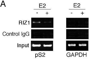 PRDM2 antibody  (AA 1-347)
