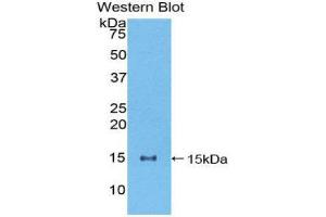 anti-Numb Homolog (NUMB) (AA 376-482) antibody