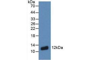 Image no. 2 for anti-S100 Calcium Binding Protein A8 (S100A8) (AA 1-93) antibody (ABIN6002545)