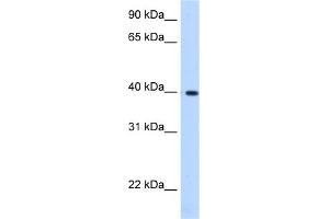 Image no. 1 for anti-Lipoic Acid Synthetase (LIAS) (C-Term) antibody (ABIN2773926)