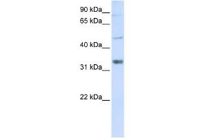 Image no. 1 for anti-Zinc Finger, CCHC Domain Containing 17 (ZCCHC17) (Middle Region) antibody (ABIN633208)