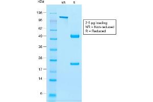 Image no. 1 for anti-NK2 Homeobox 2 (Nkx2-2) antibody (ABIN6940203)