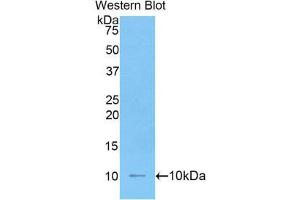 Image no. 1 for anti-Interleukin 6 Receptor (IL6R) (AA 19-10) antibody (ABIN1862786)