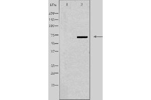 Image no. 2 for anti-ATP-Binding Cassette, Sub-Family D (Ald), Member 4 (ABCD4) (Internal Region) antibody (ABIN6257921)
