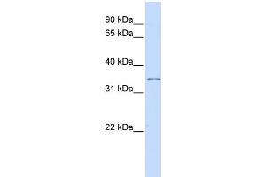 Image no. 1 for anti-Potassium Channel Regulator (KCNRG) (Middle Region) antibody (ABIN2776325)