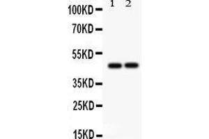 Image no. 3 for anti-Protein tyrosine Phosphatase, Non-Receptor Type 2 (PTPN2) (AA 1-330) antibody (ABIN3043447)