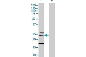Image no. 1 for anti-Tetraspanin 31 (TSPAN31) (AA 1-210) antibody (ABIN520010)