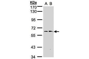WB Image Sample(30 ug whole cell lysate) A:Hep G2 , B:Raji , 7.
