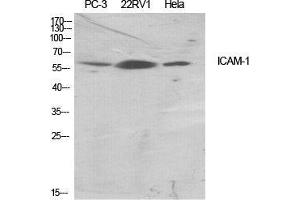 Image no. 2 for anti-Intercellular Adhesion Molecule 1 (ICAM1) (Ser518) antibody (ABIN3185121)