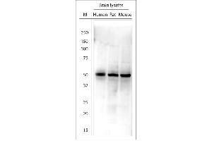 Image no. 11 for anti-Tyrosine Hydroxylase (TH) (AA 30-100) antibody (ABIN572202)