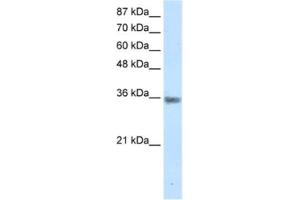 Image no. 1 for anti-Menage A Trois Homolog 1, Cyclin H Assembly Factor (Xenopus Laevis) (MNAT1) antibody (ABIN2461659)