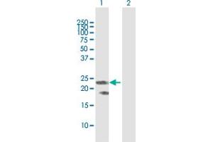 Image no. 2 for anti-Coagulation Factor VIII (F8) (AA 1-216) antibody (ABIN515451)