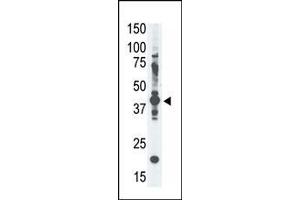 Image no. 1 for anti-Melanoma Antigen Family A, 4 (MAGEA4) (AA 9-38), (N-Term) antibody (ABIN390108)