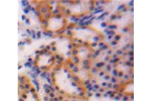 Image no. 2 for anti-Connective Tissue Growth Factor (CTGF) (AA 25-348) antibody (ABIN1077951)